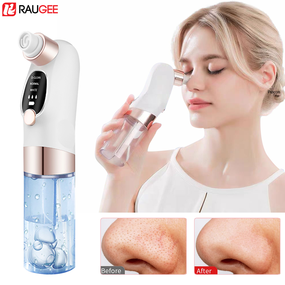 Air Bubble Remover - Mee-eter verwijderaar Elektrische mee-etertrekker Poriestofzuiger Micro