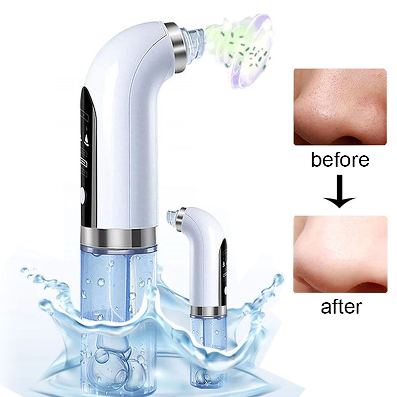 Water Dermabrasie Hydra Peelin - Air Bubble Remover recensie en prijs