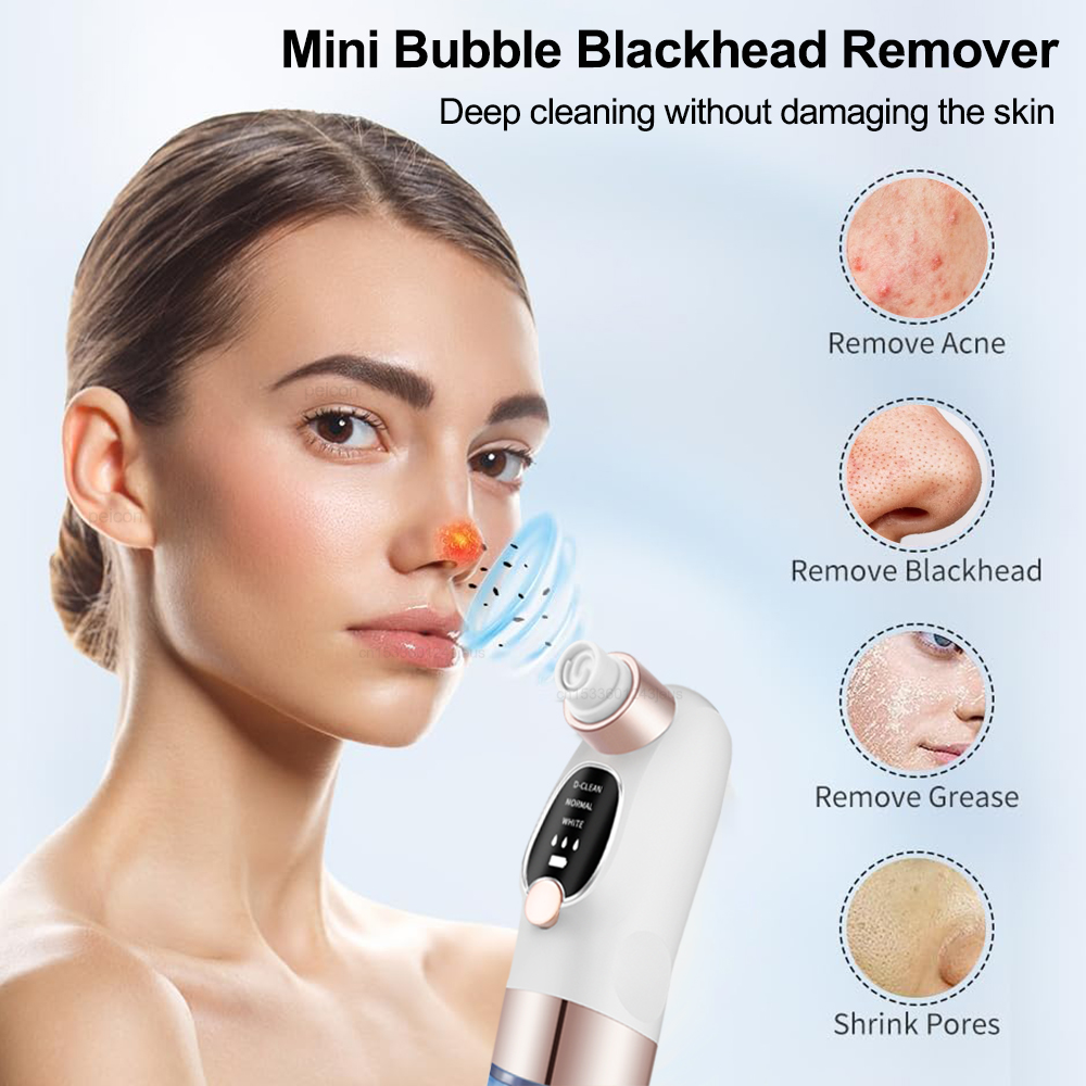 Mee-eter verwijderaar Elektris - Air Bubble Remover recensie en prijs